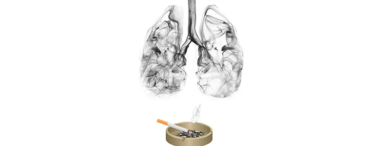 5 Strategies to Help You Quit Smoking