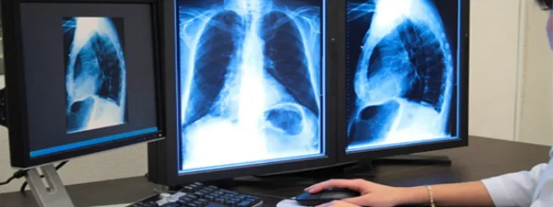 Introducing Enterprise Imaging – AKUH’s New Cutting-Edge Medical Imaging System
