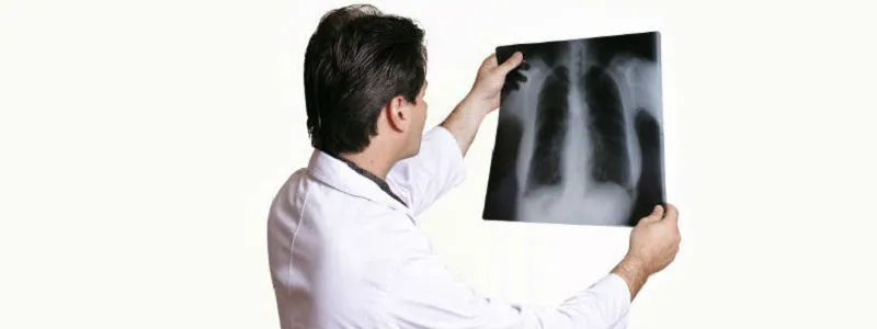 World Tuberculosis Day