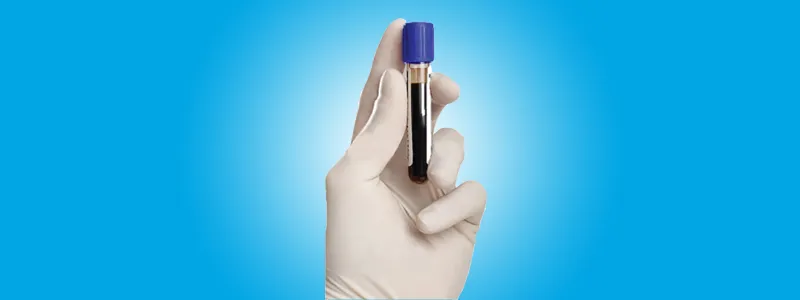Clifton Medical Services Laboratory NOW Open 24/7
