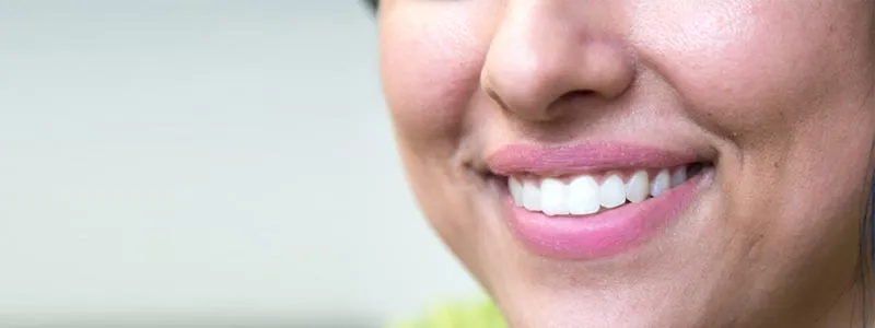 A Perfect Smile
