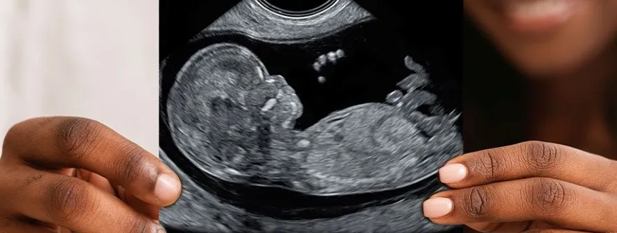 Baby girl or baby boy - Who determines between either partners