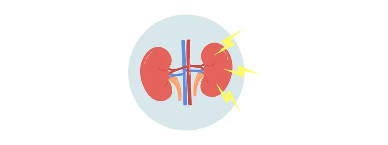 Diabetic Kidney Disease: A Growing Health Crisis in Pakistan